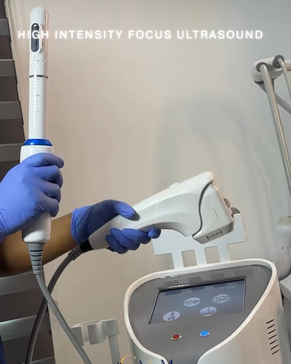 High Intensity Focused Ultrasound treatment handpiece at C.A.L.M
